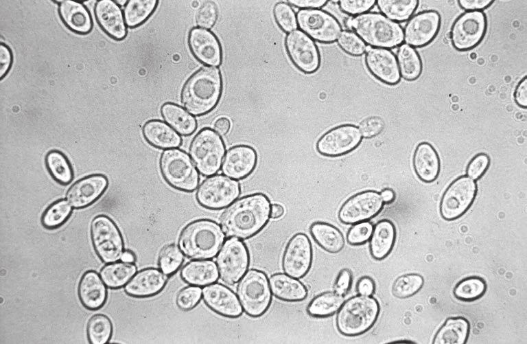 6 2 Yeast cells have a cell wall on the outside that appears as a dark layer and a large paler coloured vacuole occupying most of the cell.