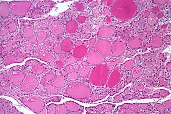 Thyroglobulin is Stored in the Follicles of the Thyroid Follicles containing thyroglobulin Each of the round structures seen in