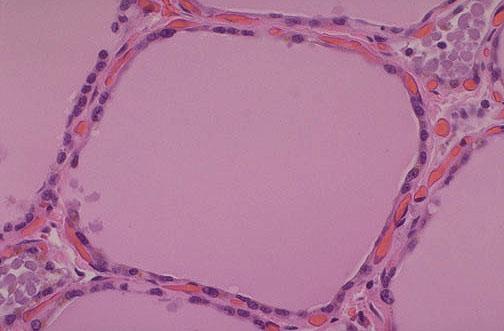 Thyroid Follicles Follicular cells Thyroglobulin Parafollicular cells capillaries The follicular cells produce and