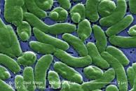 coli O157H7 infection Cholera