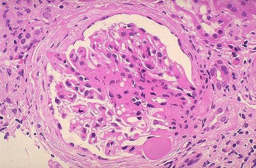 Does this glomerulus look normal? Hypoalbuminemia and proteinuria suggest that what structures shown in the above picture are likely to be damaged?