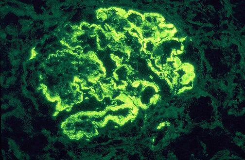 Immunofluorescence image staining for IgM: Does