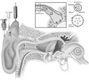 nists- tinnitus Monoclonal antibodies autoimmune inner ear Apoptosis inhibitors (e.g.