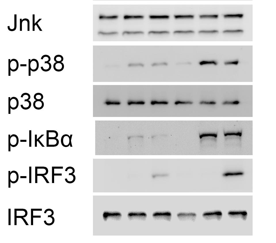 Immunoblot analysis of phosphorylated or total ERK, JNK, p38, IκBα, IRF3 in lysates of H2 -/- or H2 +/+