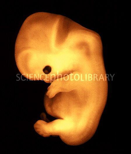 Embryo: 2