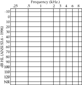 Basic Audiogram Interpretation Audiogram - graph showing Frequency on Horizontal axis db Hearing Level on Vertical axis db level