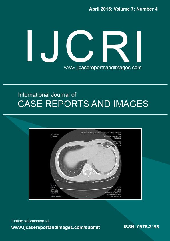 www.edoriumjournals.com CASE REPORT PEER REVIEWED OPEN ACCESS Redistribution of pericardial effusion during respiration simulating the echocardiographic features of cardiac tamponade Raymond Maung M.