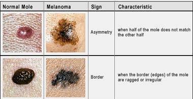 There were about 95,880 new cases of melanoma in 2004. This is a 4% increase from 2003.