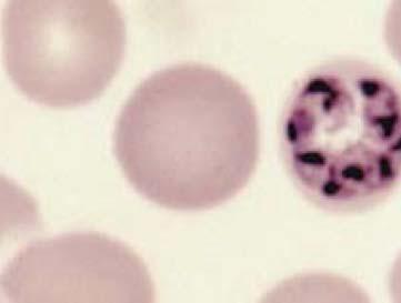 The Malarias: Plasmodium falciparum Plasmodium vivax Plasmodium