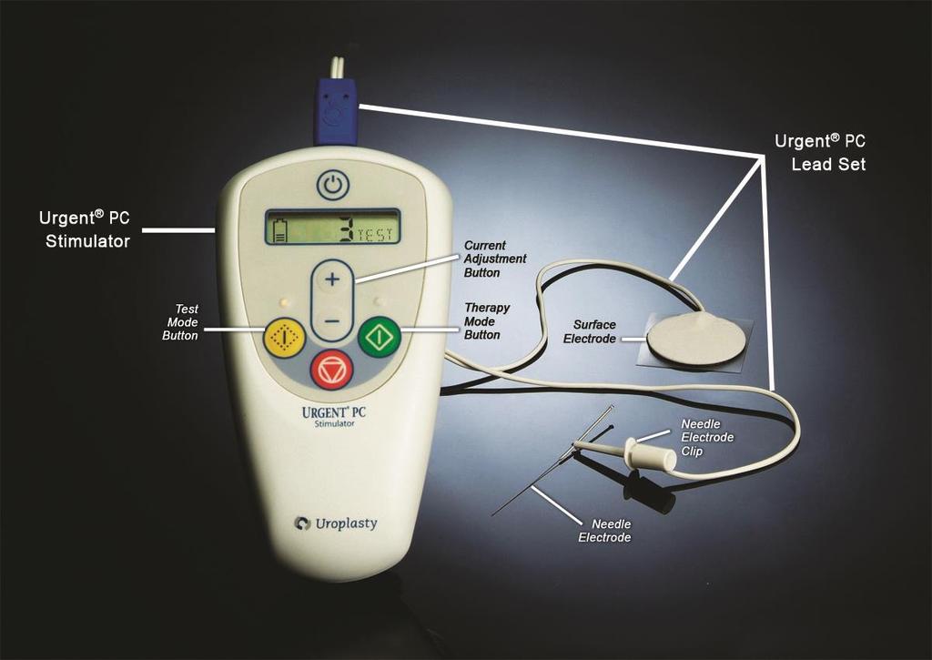 Urgent PC Neuromodulation System Less invasive NM, alt option to SNS Involves a battery powered, external electrical pulse generator & acupuncture type