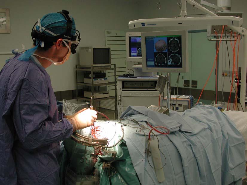 Surgery -stereotaxy Allows navigation in virtual