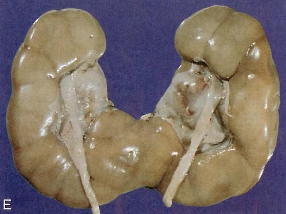 Urinary system Congenital anomalies 1.
