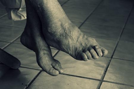 Foot health problems and falls Foot health problems are common in older people.