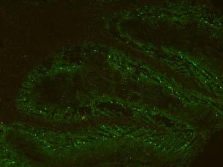 Stained with antibody and fluorescent conjugate.