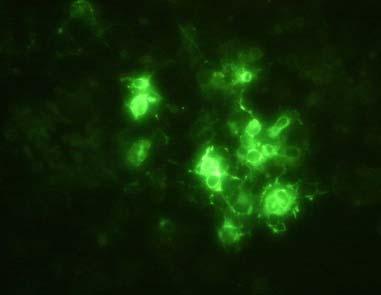 For the staining, the cells were incubated with a monoclonal antibody specific