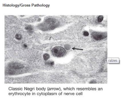 Negri bodies are eosinophilic, sharply outlined, pathognomonic inclusion bodies (2 10 µm in diameter) found in the cytoplasm of certain nerve cells containing the virus