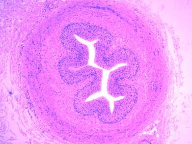 glomerular capsule). Examine a glomerulus at 400x magnification (Figure 23.7).