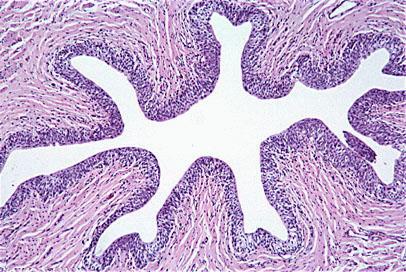 Mucosa of transitional epithelium allows expansion and damping of
