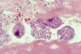 Pneumocystis, endospores of C.