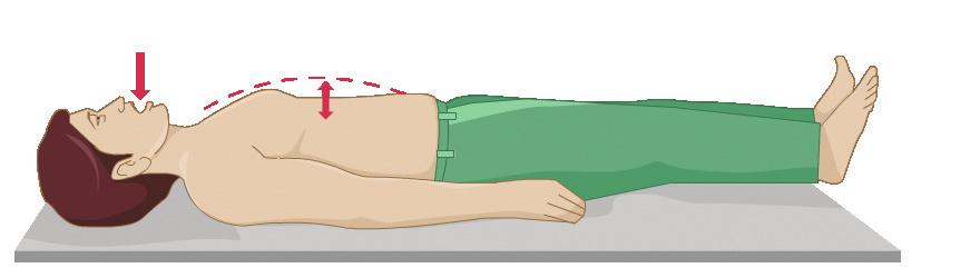 Figure 3: Initial treatment of anaphylaxis 1 Ensure a written emergency protocol for
