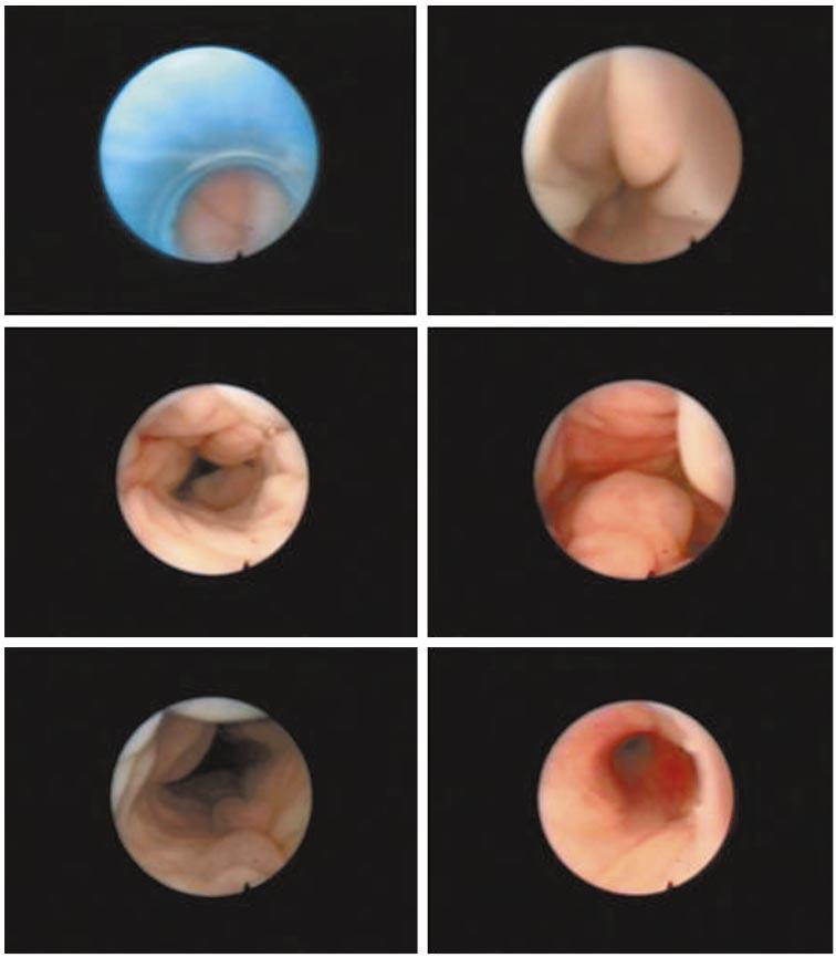 292 E. A. Martinez et al. (a) (b) (c) (d) (e) (f) Fig. 1. Endoscopic images of different parts of the genital tract during oestrus in sows.