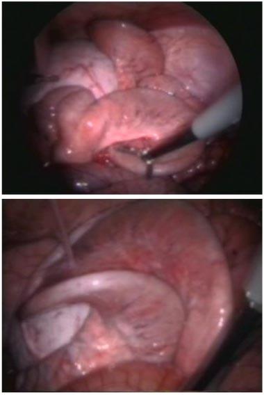 Non-surgical deep uterine insemination in sows 293 (a) (b) Pregnancy and farrowing rate (%) 100 80 60 40 20 0 100 20 5 Control 100 20 5 Control Number of spermatozoa inseminated ( 10 7 ) Fig. 3.