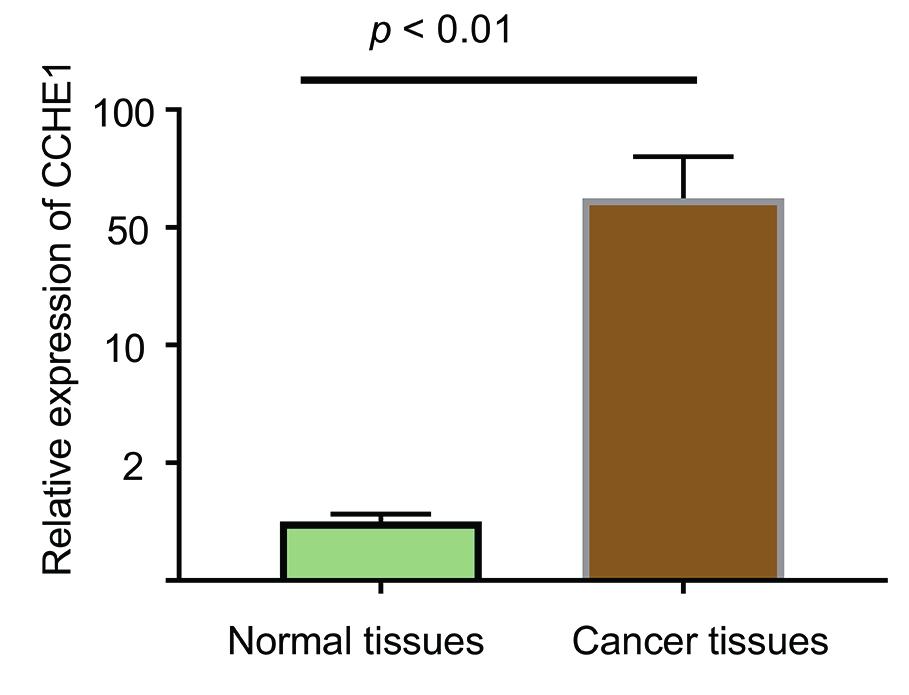 Y. Chen, C.-X. Wang, X.-X. Sun, C. Wang, T.-F. Liu, D.-J. Wang Table I. Association between CCHE1 expression and clinicopathological parameters in 141 patients with cervical cancer.