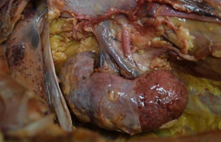 seen on cadaver as a white layer Layer of adipose connective