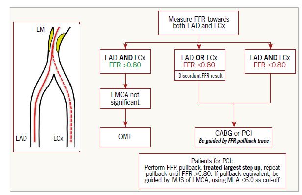 LMS Left Main Stem Algorythm with FFR LMS lesions