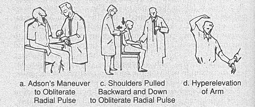 (plus Valsalva) Examination for suspected thoracic outlet