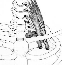 The Thoracic Outlet Three tight spaces: 1. Between scalenes 2. Costoclav.