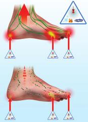 Damage to the nerves and blood supply to your feet makes it more likely that you will develop foot problems.