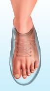 Here are the key things you can do to look after your feet:. This means washing and moisturising your feet and checking them for injuries or changes to your skin.