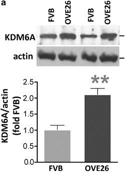 An increase in KDM6A in the diabetic kidney KDM6A: