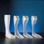 Nonsurgical Treatment - Accommodative High-topped shoes Lace-up braces Ankle foot orthosis