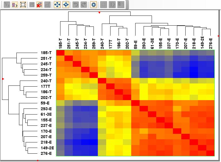 Brain Tumor Study: Sample-sample Correlation and PCA of Discovery Proteomics Data Tumor subgroups