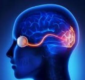 Cerebral visual impairment- CVI Visual loss resulting from