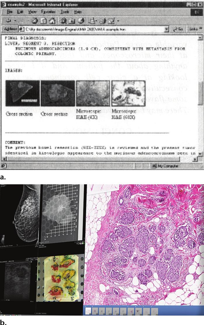 476 March-April 2018 radiographics.rsna.org Figure 16. Two examples of multimedia reports used in pathology.