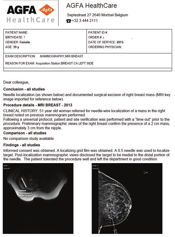 Multimedia report from the Agfa HealthCare platform includes a needle-localization mammogram (bottom right) and a correlative breast MR image (bottom left). (Courtesy of Agfa HealthCare.