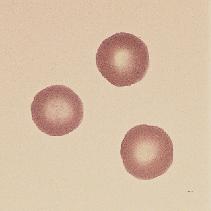 PLATE 1. Red Blood Cell Development Rubriblast The rubriblast is a large, round cell with a large, round nucleus; coarsely granular chromatin; and a nucleolus.