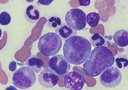 The largest cell in the right center of the field that has small pink granules in the cytoplasm is a promyelocyte. Canine bone marrow smear; 100 objective. Figure 1.6 5 Figure 1.