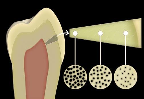 Dentin Conditioning It is difficult to differentiate precisely between the dentin and pulp. The correct description is therefore pulp-dentin unit.