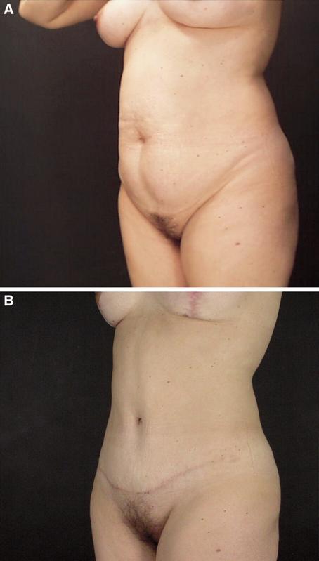(B) The same patient 9 months postoperatively. Fig. 8.