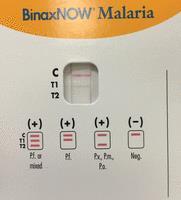 uk/ Always take an EDTA sample for malaria parasites