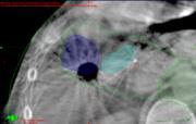 Beam CT Axial Anterior Sagittal Superior