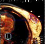 Image Quality for setup at other disease sites Breast Pelvis (Bladder, GYN, Rectal, Prostate)