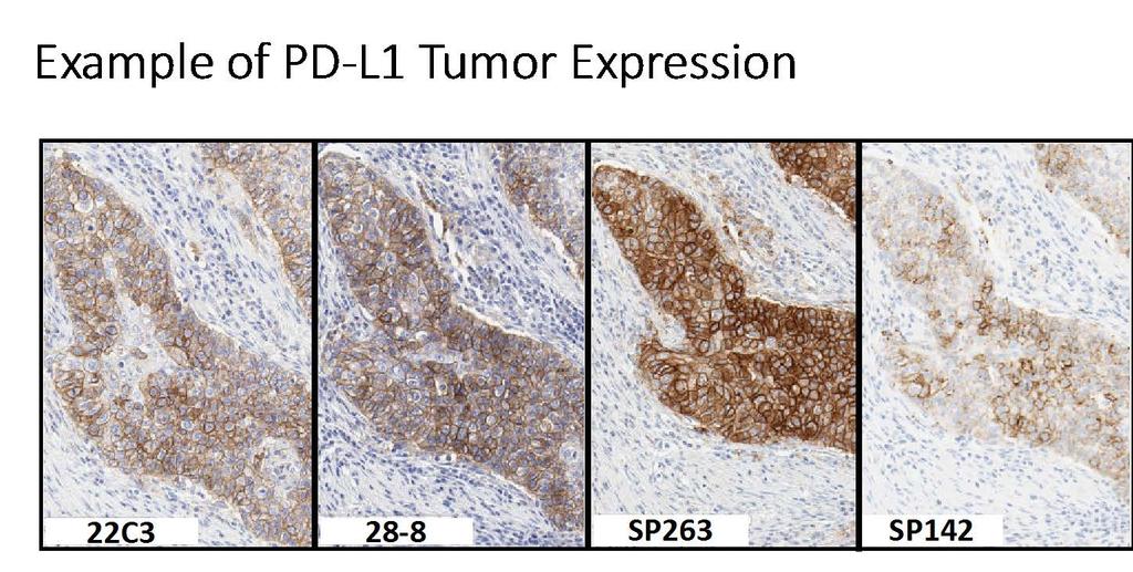 The PD-L1 Blueprint Working Group (IASLC-Industry) 39 cases x 4 assays, scored for % tumor cell and