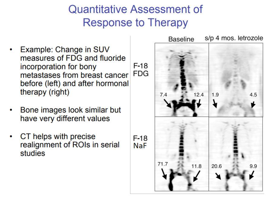 12. TYPICAL F-18 FDG PET SCANS IN