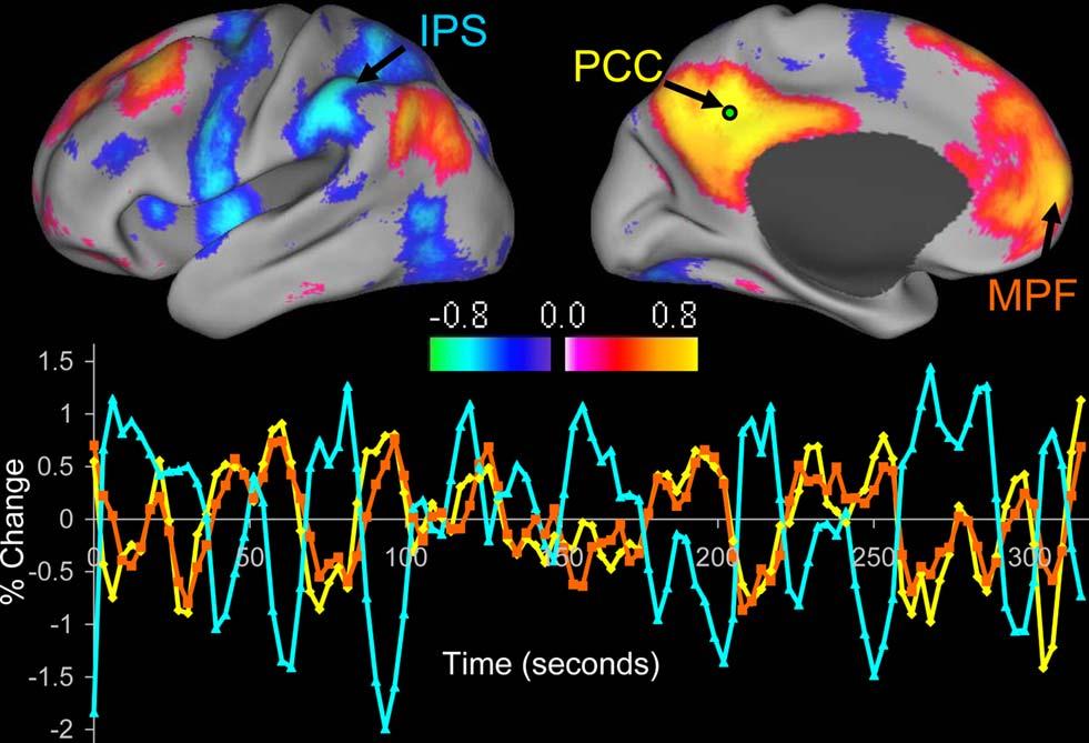 Important note Power-based connectivity is most similar to fmri connectivity measures that correlate BOLD time