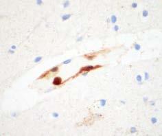 Microglial activation H&E Cleaved Casp